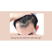 Nang tóc bị chết thì nên làm gì?