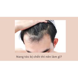 Nang tóc bị chết thì nên làm gì?