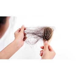 Rụng tóc có phải do thiếu sắt không?