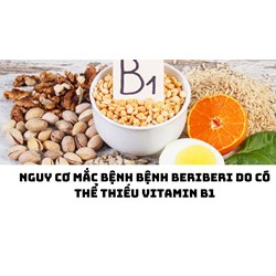 Nguy cơ mắc bệnh bệnh Beriberi do có thể thiếu vitamin B1