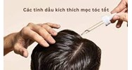 Các tinh dầu kích thích mọc tóc tốt nhất