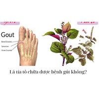 Lá tía tô chữa được bệnh gút không?