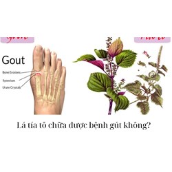 Lá tía tô chữa được bệnh gút không?