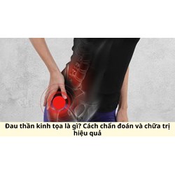 Đau thần kinh tọa là gì? Cách chẩn đoán và chữa trị hiệu quả